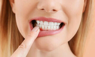 best teeth doctor for root canal in Surat