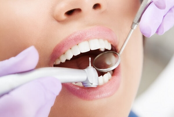 Best Tooth Filling Treatment Doctor in Gujarat