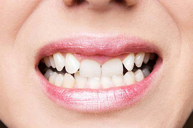 leading tooth treatment clinic