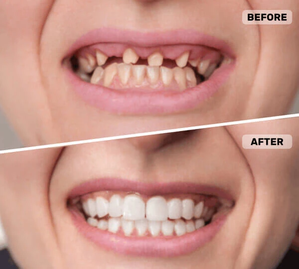 best dental implants in Gujarat