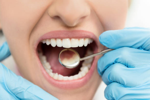 dental implants in Surat are one stop solution for several dental problems