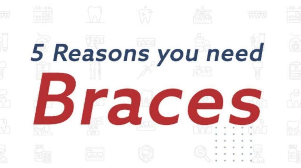 5 Reasons you need braces