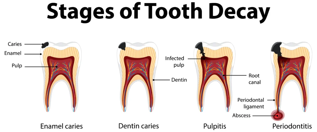 Dental Issues