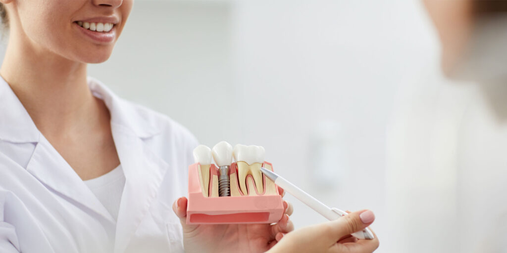 dental implants are Beneficial To Your Health
