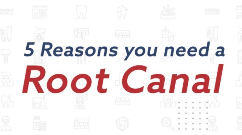 Root Canal in Surat,