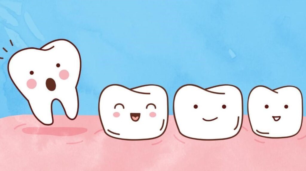 Tooth Loss