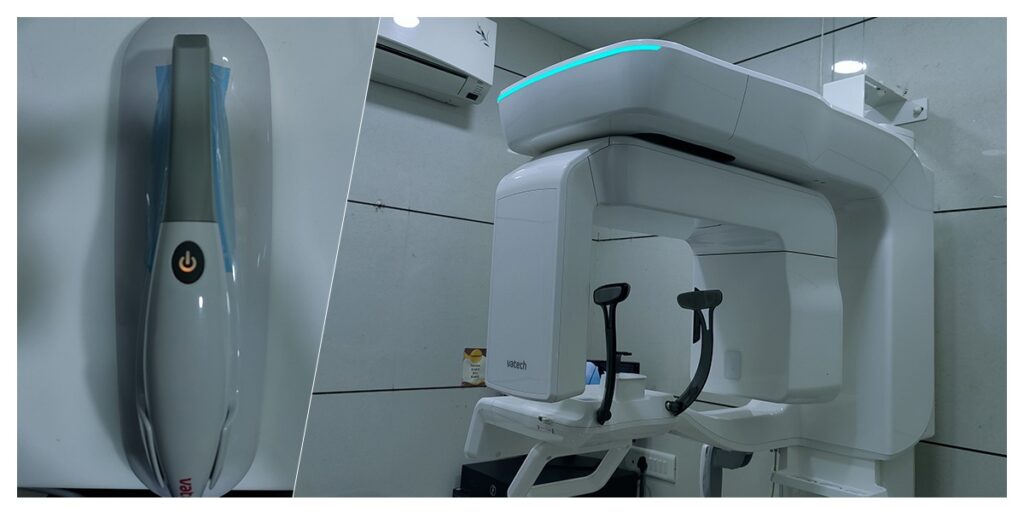 Dental Scanner