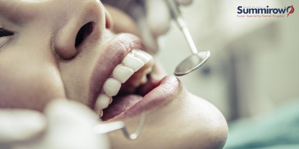 Full-mouth dental implants in 72 hours.