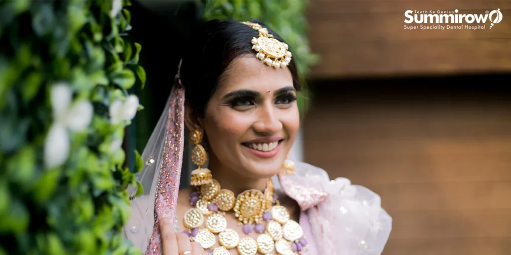 Wedding and Digital Smile Design: Crafting Your Special Day of a Lifetime