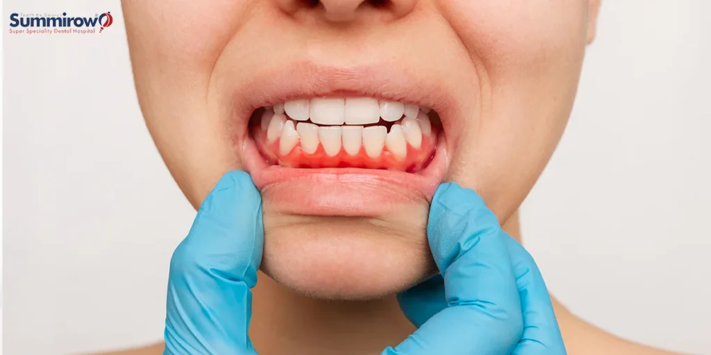 How Timely Oral Cancer Detection Can Save Your Life