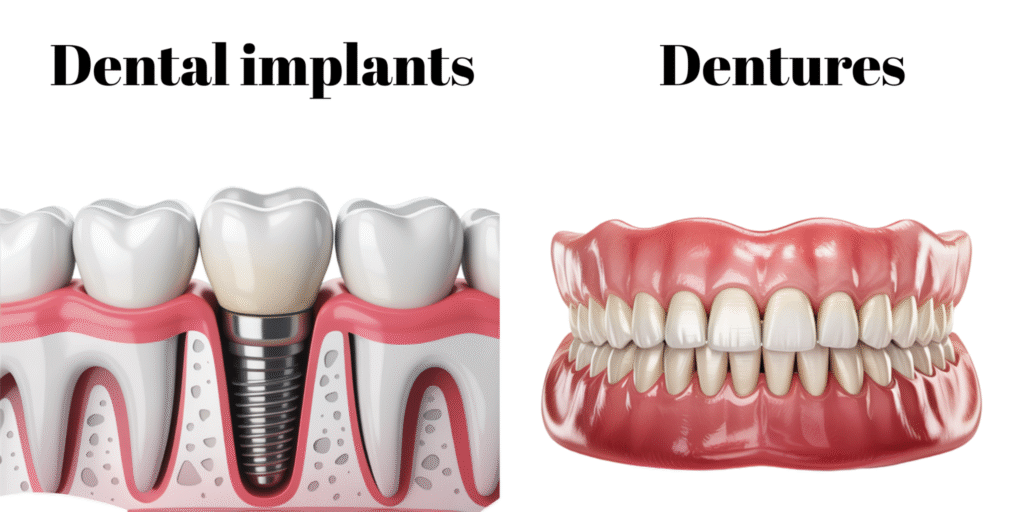 Dental Implants vs. Dentures