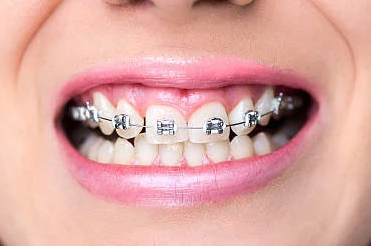 best smile makeovers in Gujarat