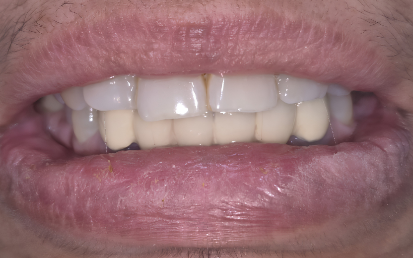 After