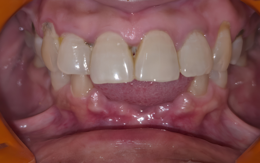 Before