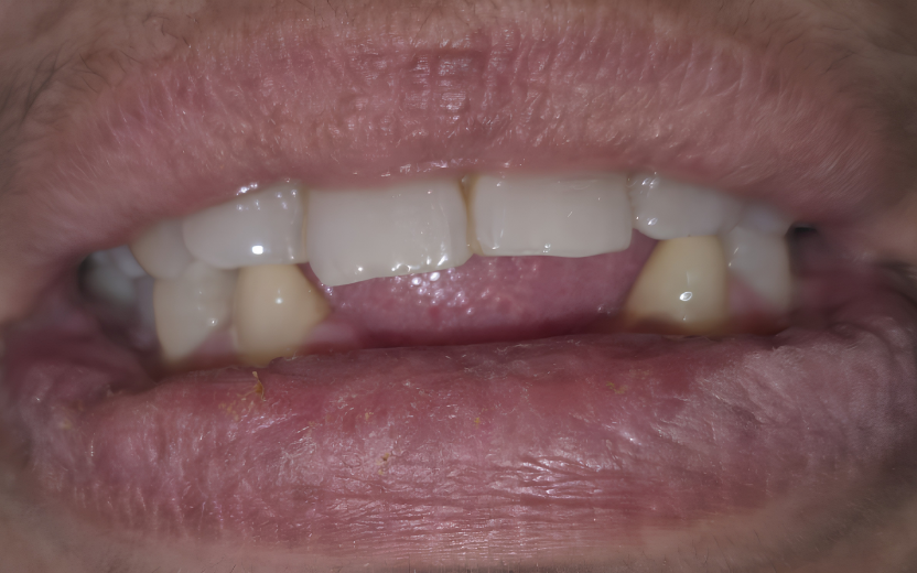 Before