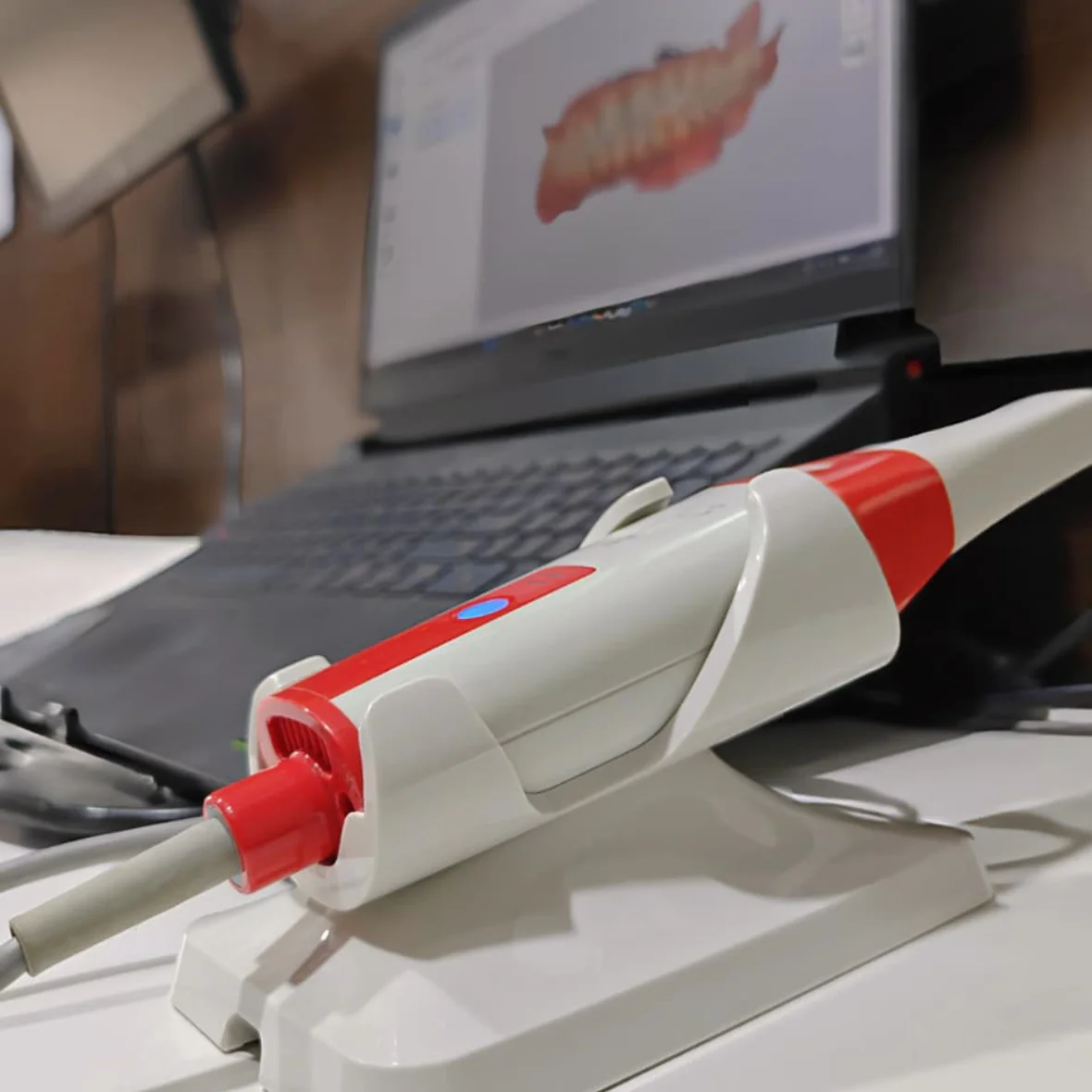 Advanced dental implant technology at Summirow Dental Surat