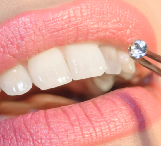 Best Cosmetic Dentistry