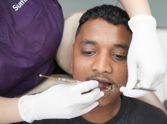 Dental Fillings