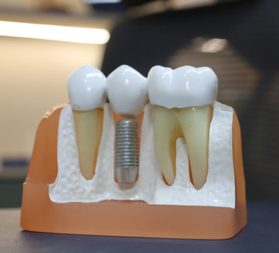 Basal Dental Implants