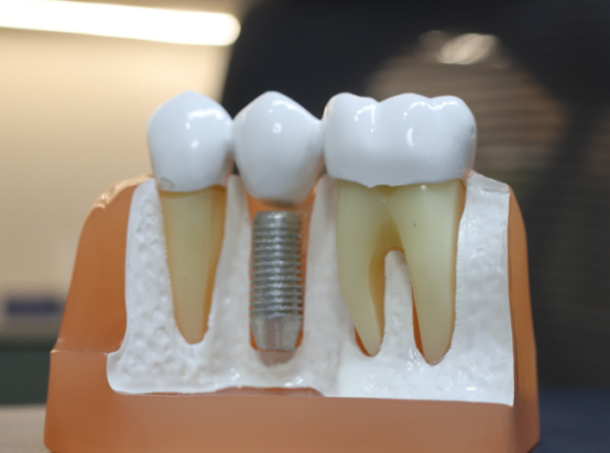 Basal Dental Implants