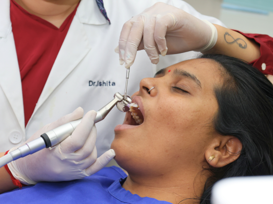 Dental Scaling & Polishing