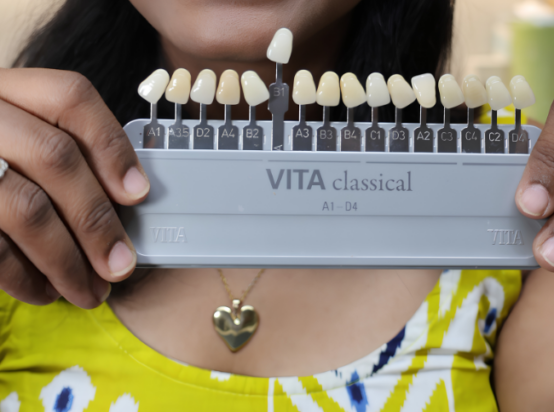 Dental Veneers