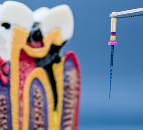 Endodontic & Conservative Dentistry