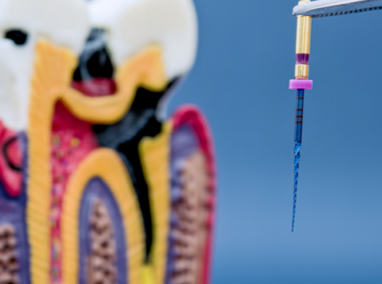 Endodontic & Conservative Dentistry