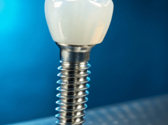 Immediate Dental Implants