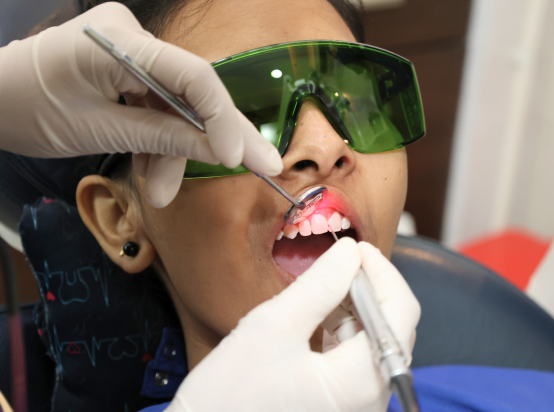 Laser Dentistry