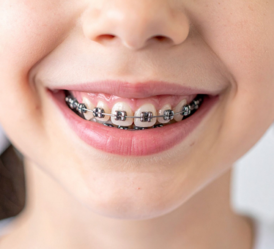 Pediatric Orthodontics