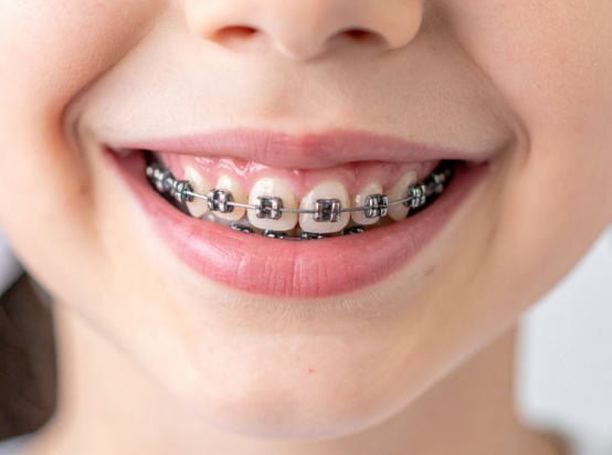 Pediatric Orthodontics