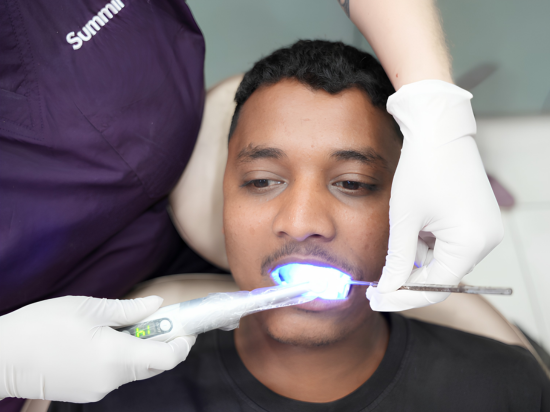 Teeth Whitening