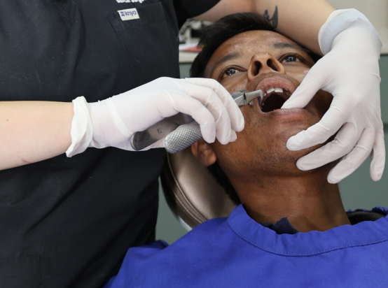 Dental Extraction