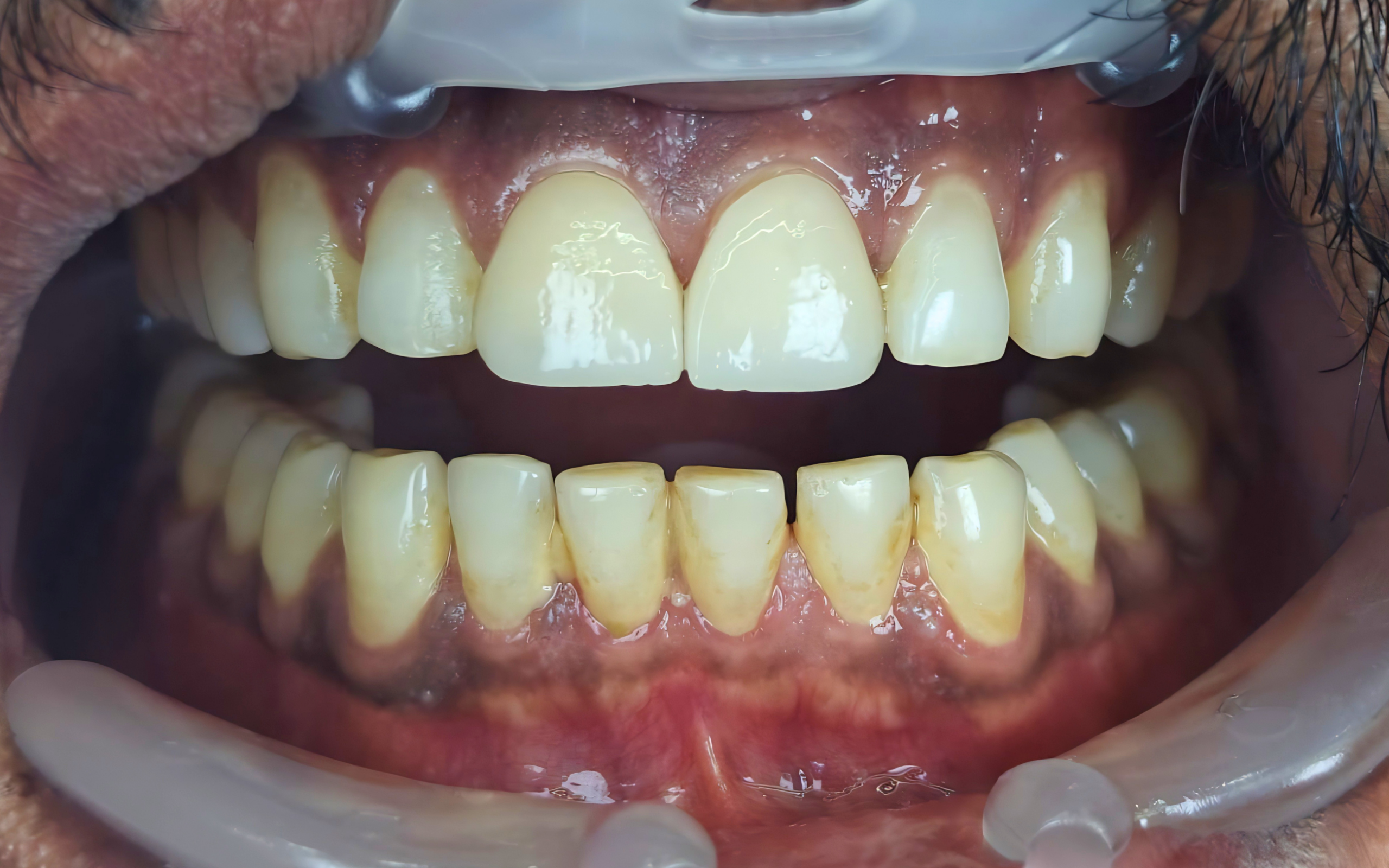 After