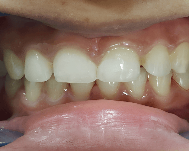 Before
